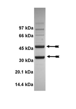 Eurofins DiscoverX Cdk5/p25 Protein, Active 10 &mu;g | Buy Online | Eurofins DiscoverX | Fisher Scientific